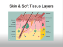 Skin, Soft Tissue, & Bone Infections