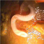 whipworm Image from CDC website