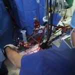 Cardiac-Surgery-17